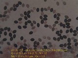 Psilocybe coprophila image