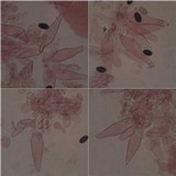 Psathyrella bipellis image