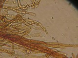 Tomentella fibrosa image