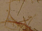 Tomentella fibrosa image