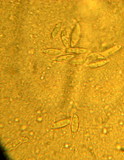 Chrysomphalina chrysophylla image