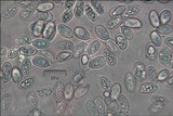 Melanoleuca evenosa image