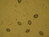 Melanoleuca melaleuca image