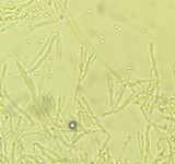 Penicillium vulpinum image