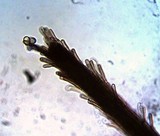 Paradidymobotryum oblongum image