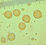 Amanita crassiputamen image
