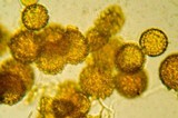 Octaviania tasmanica image