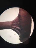 Laccaria amethystina image