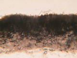 Helminthosphaeria clavariarum image