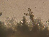 Helminthosphaeria clavariarum image