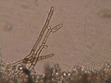 Helminthosphaeria clavariarum image