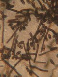 Helminthosphaeria clavariarum image