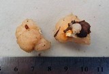 Tremella encephala image