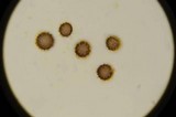 Scleroderma reae image