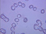 Armillaria solidipes image