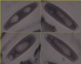 Varicellaria velata image
