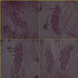 Leptogium cochleatum image