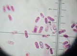 Resupinatus alboniger image