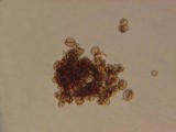 Cystodermella granulosa image