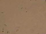 Cystodermella granulosa image