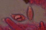 Aphelaria tuberosa image