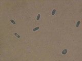 Hyphoderma setigerum image