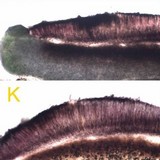 Tephromela atra var. atra image
