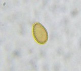 Ganoderma sessile image