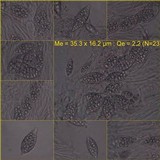 Leptogium gelatinosum image