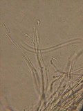 Lophodermium rubicola image