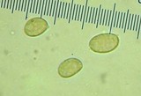Pseudoclitocybe cyathiformis image