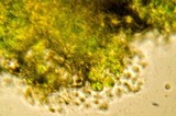 Parmotrema perlatum image