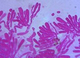 Mucronella bresadolae image