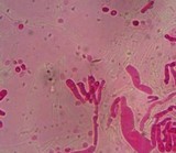 Mucronella pulchra image