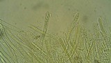 Bisporella sulfurina image