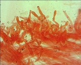 Contumyces rosellus image