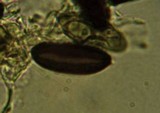 Rosellinia aquila image