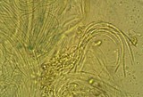 Stictis radiata image