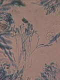 Micropeziza cornea image