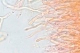 Dacrymyces capitatus image