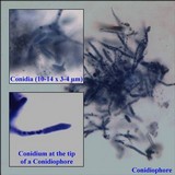 Hypomyces papulasporae image