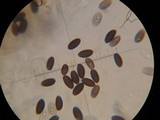 Psathyrella atrospora image