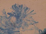 Clavaria acuta image
