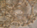 Arcyria obvelata image