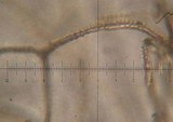 Arcyria obvelata image