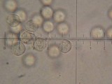Arcyria obvelata image