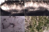 Pertusaria ophthalmiza image