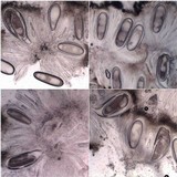 Pertusaria ophthalmiza image