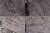 Pertusaria ophthalmiza image