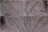 Pertusaria ophthalmiza image